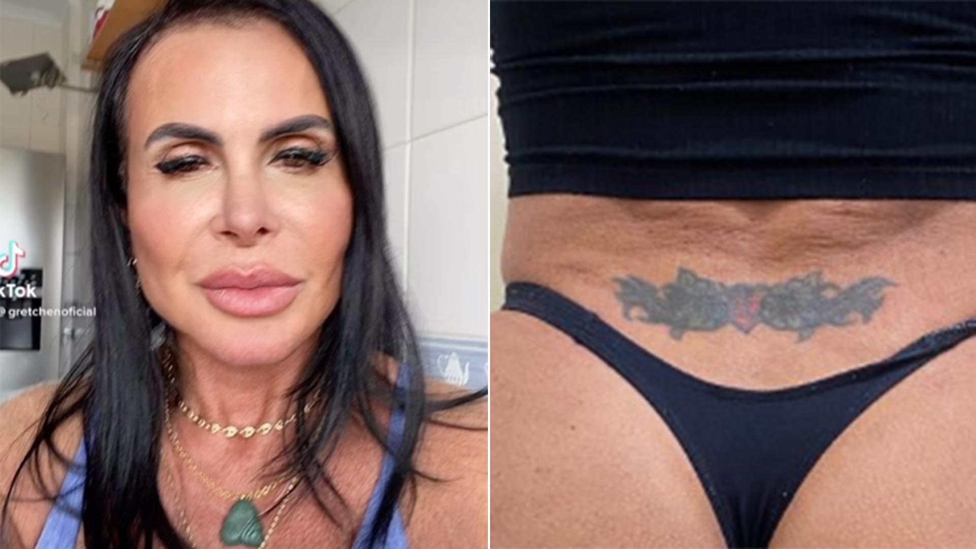 Gretchen exibe antes e depois do seu bumbum ao fazer procedimento