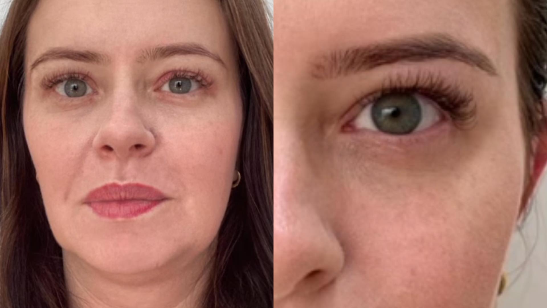 Mari Bridi faz harmonização facial e resultado surpreende: “Natural”