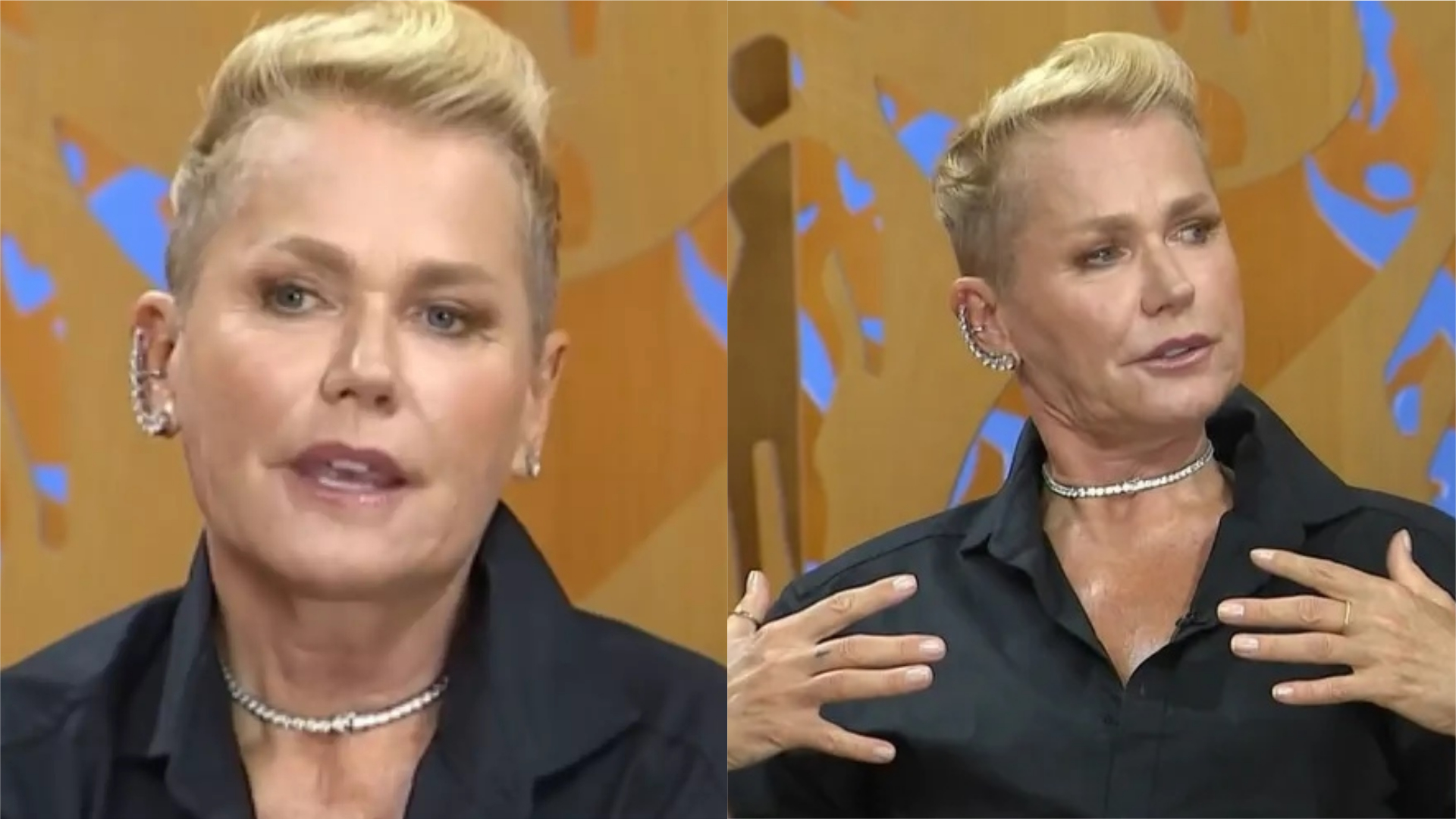 Xuxa conta que fez cirurgias estéticas não-autorizadas: “Fiquei paralisada”
