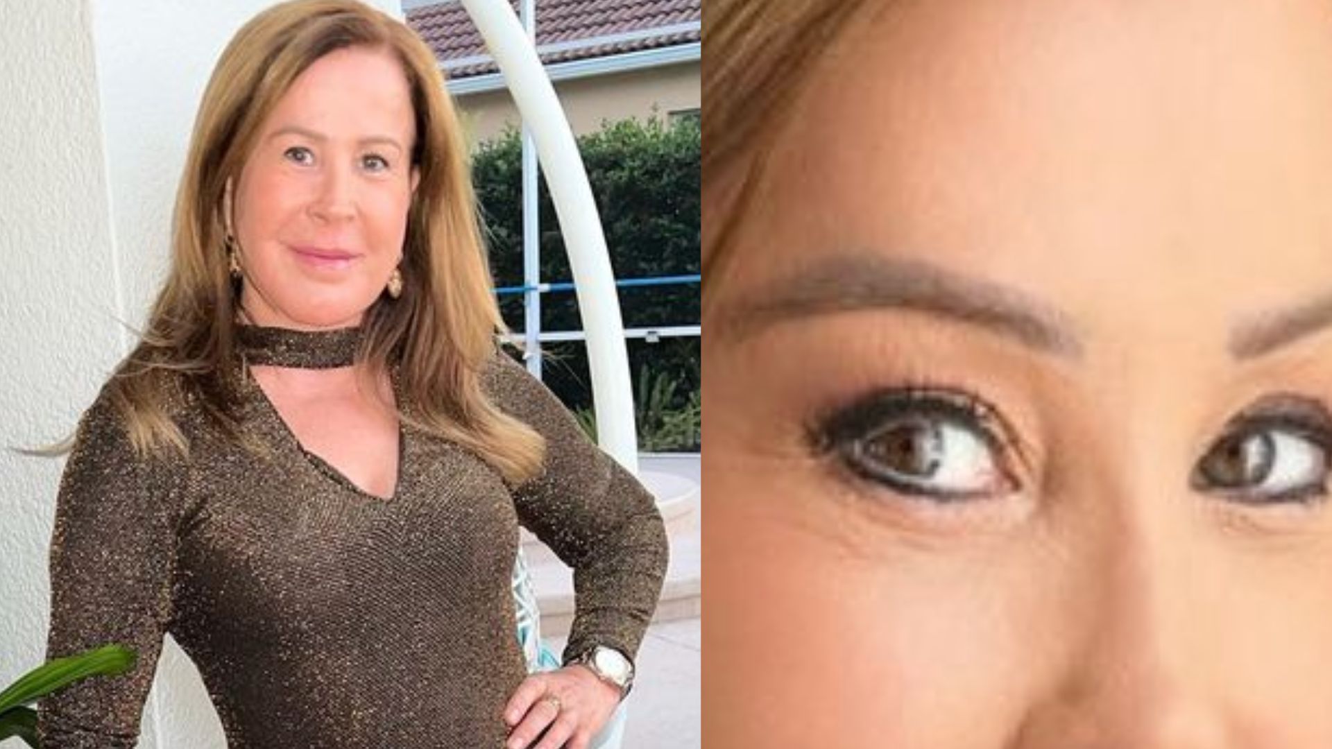 Aos 64 anos, Zilu Camargo exibe rostinho de menina e web reage: “Muito artificial!”