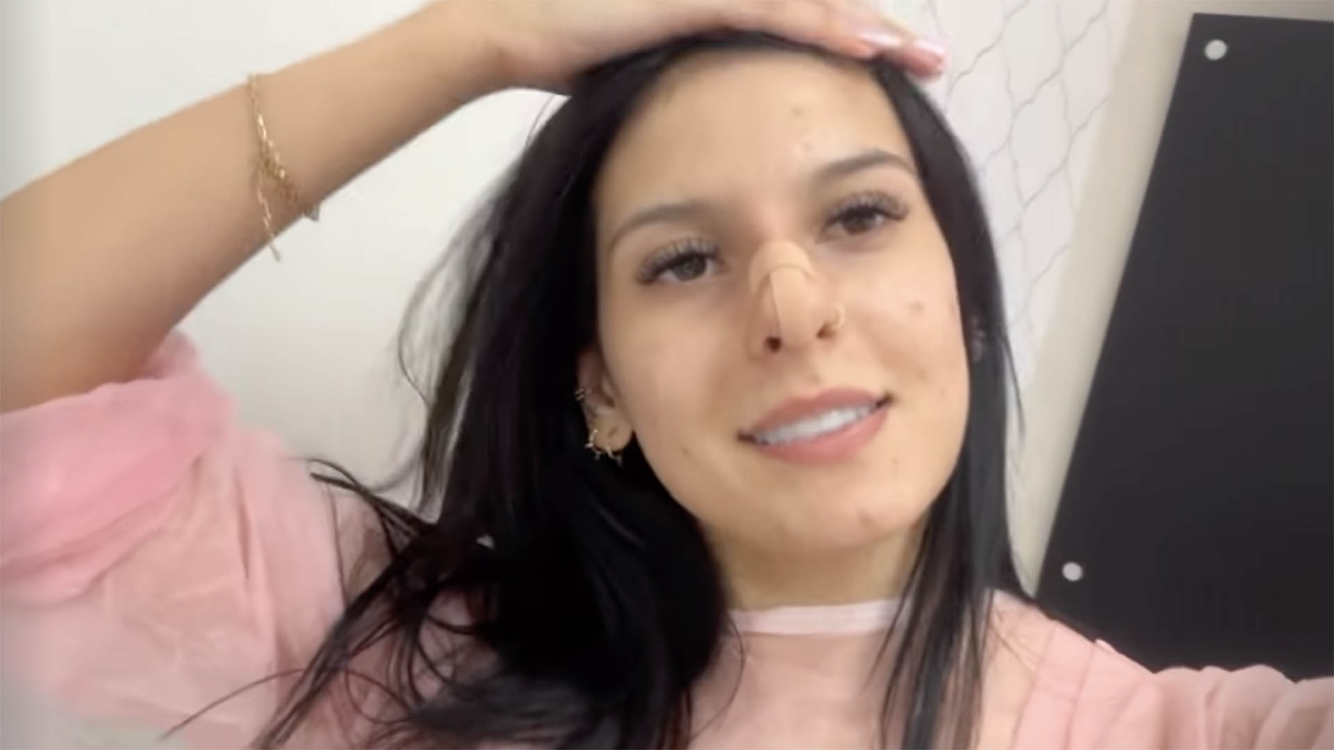 Ana Castela faz procedimento no nariz e mostra antes e depois