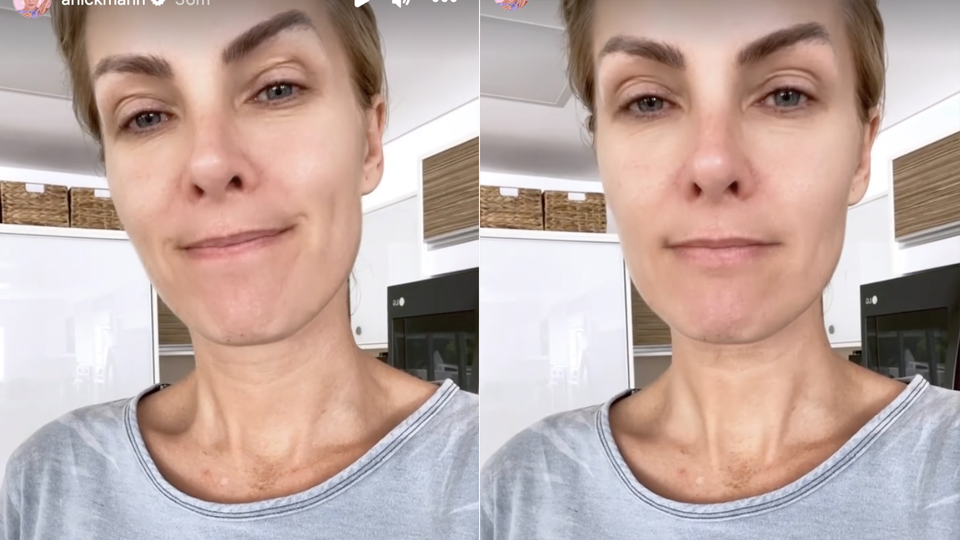 Abatida, Ana Hickmann volta à internet: ‘Muita coisa que estava machucando’