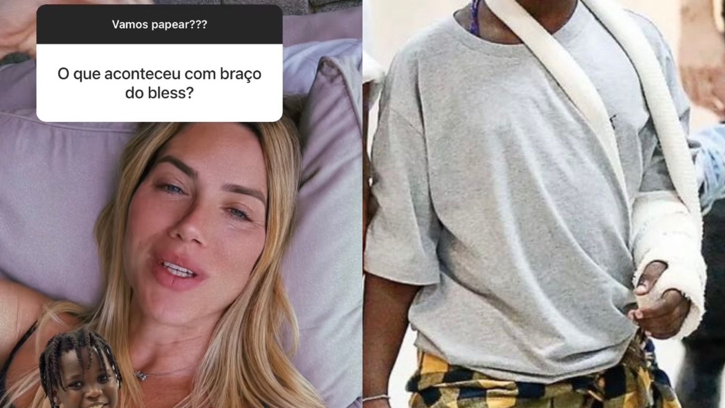 Giovanna Ewbank explica gesso no braço do filho, Bless