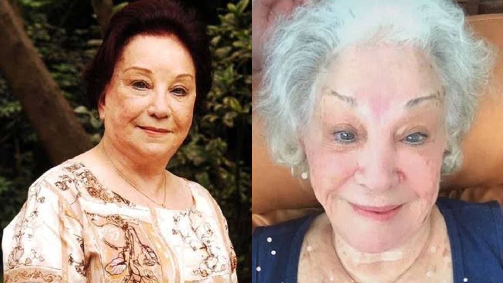 Por onde andava  Lolita Rodrigues? Artista estava reclusa e longe dos holofotes
