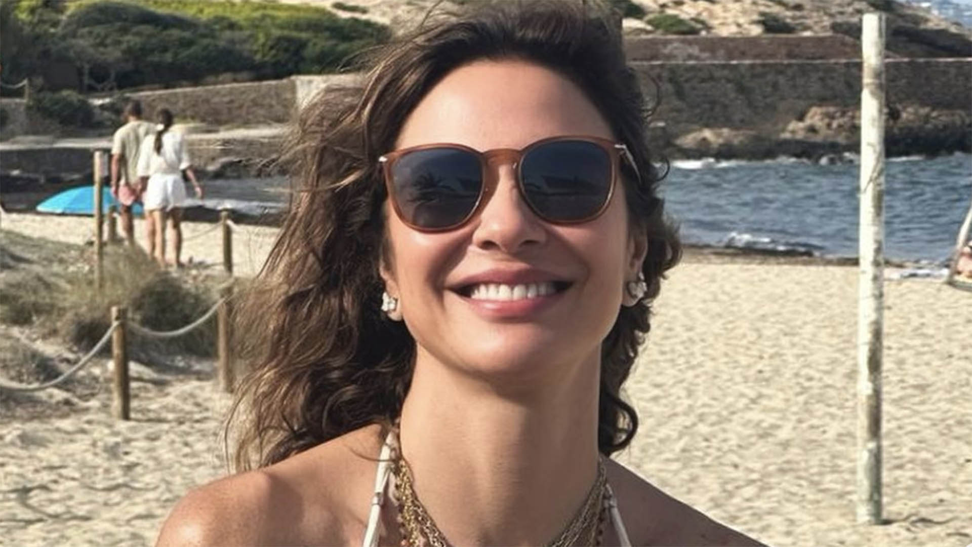 Luciana Gimenez revela quais são as sequelas de acidente em seu corpo