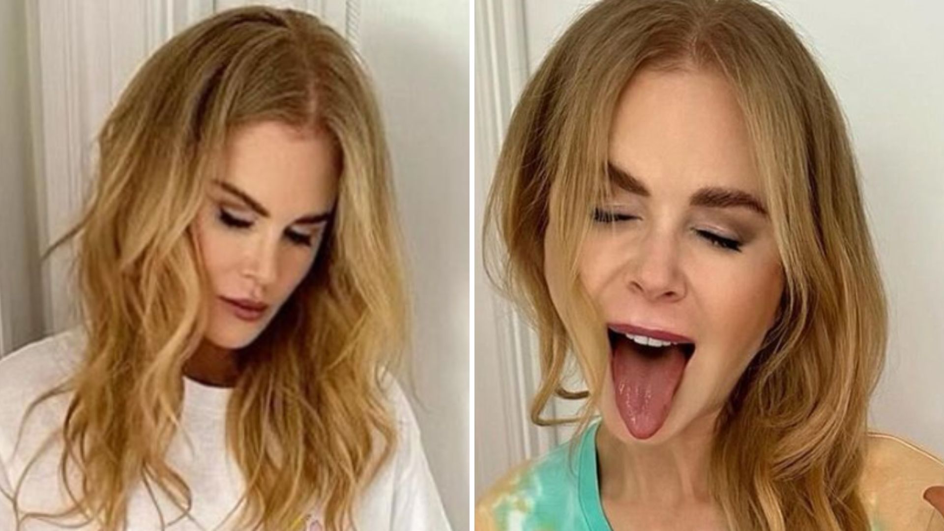 Nicole Kidman assusta fãs ao surgir muito magra; atriz estaria pesando 47 kg