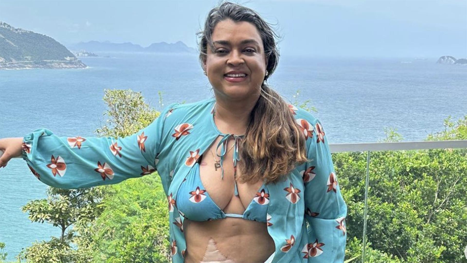 Preta Gil deixa a bolsa de ileostomia à mostra em novas fotos