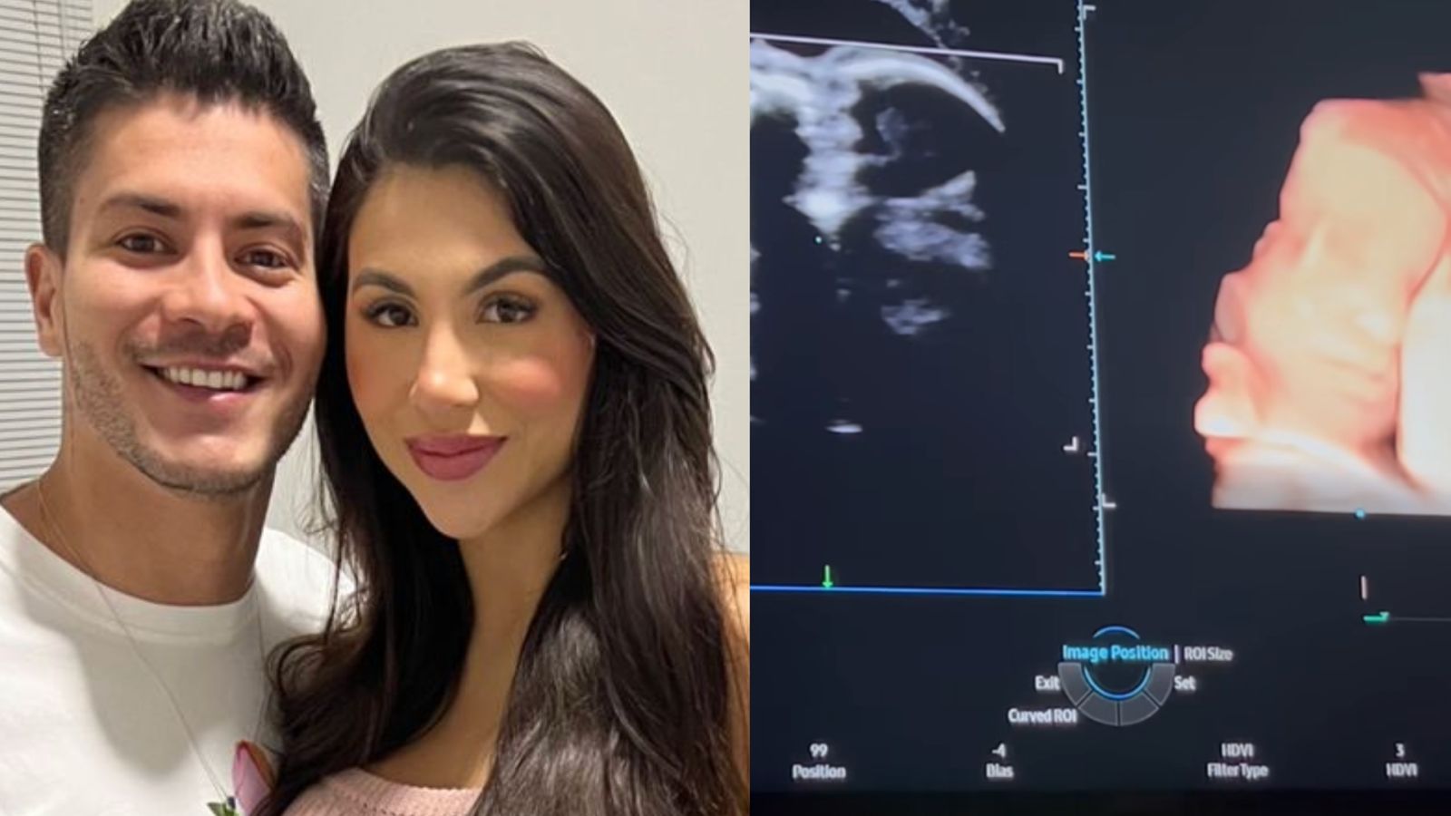 Arthur Aguiar se derrete em ultrassom do filho com a ex, Jheny Santucci: “Nosso bebê”