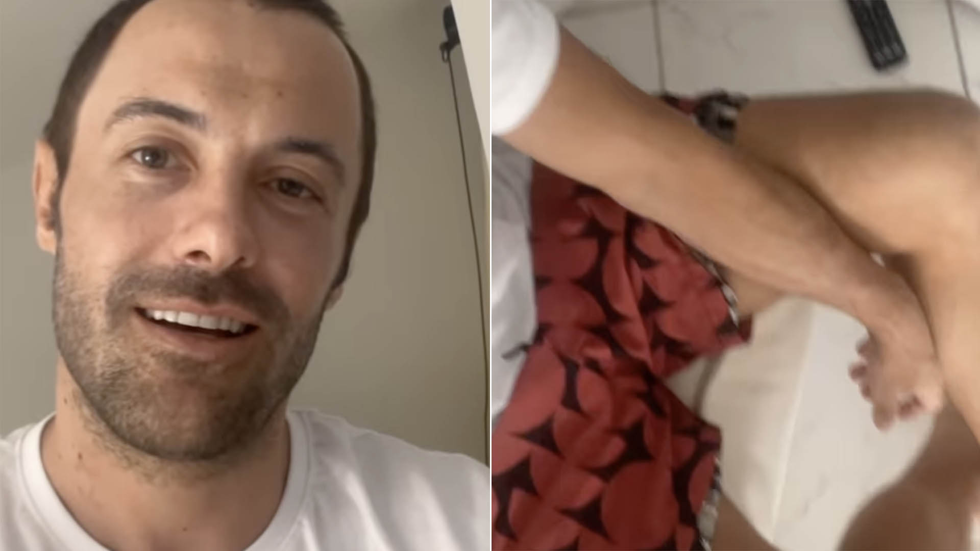 Kayky Brito revela detalhe de sua recuperação: ‘Lado direito um pouco afetado’
