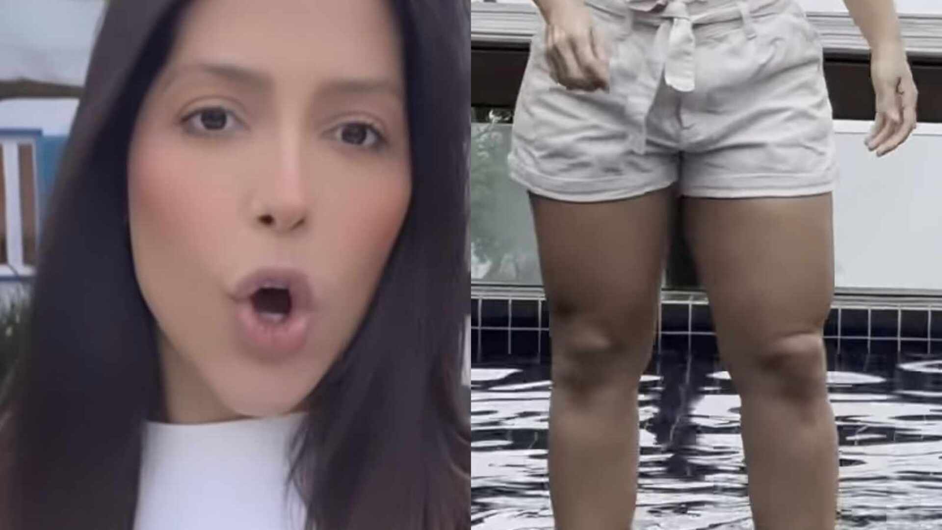 Laís Caldas causa ao mostrar seus joelhos: ‘Será que tenho que fazer harmonização?’