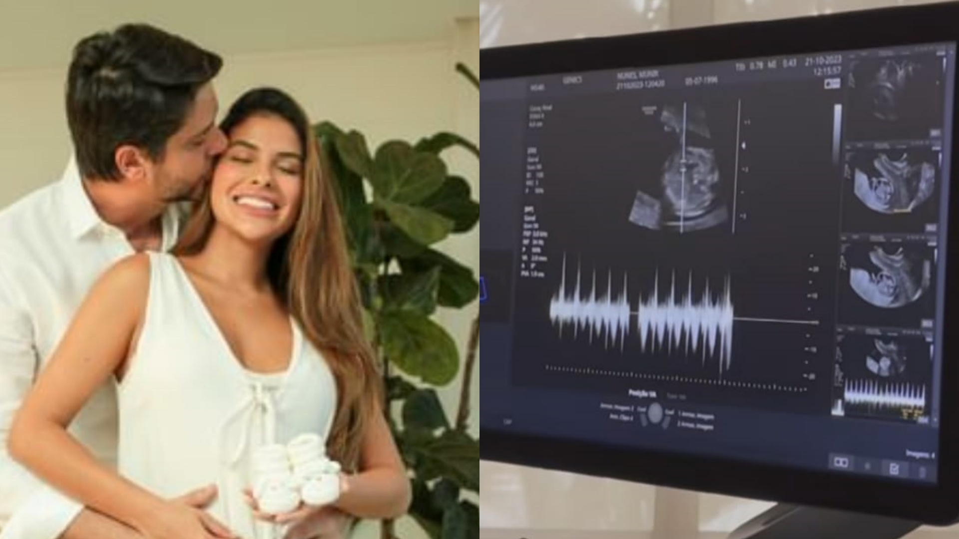Ex-BBB Munik Nunes anuncia gravidez: “Nossa família cresceu”