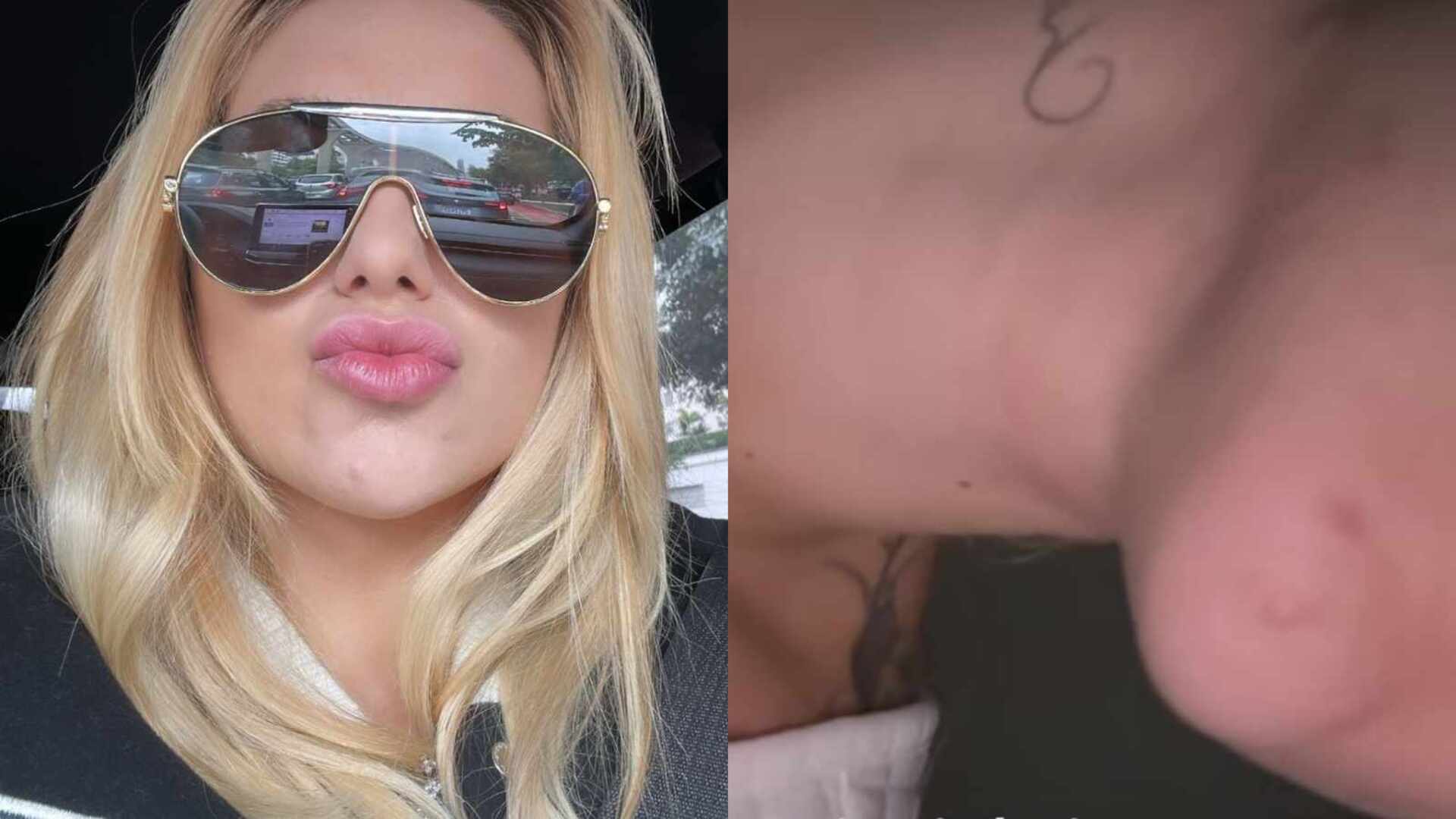 Após passar muito mal, Virginia Fonseca acorda com marcas: ‘Misericórdia’