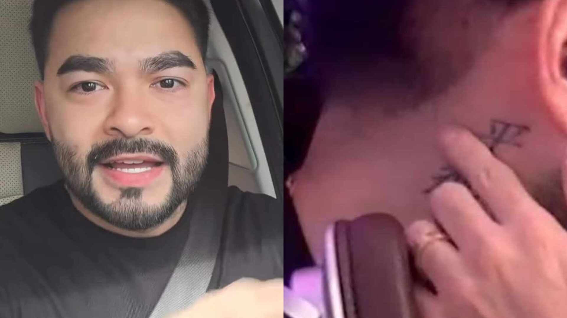 Yudi Tamashiro mostra o efeito do estresse em seu corpo: ”Minha vida toda”