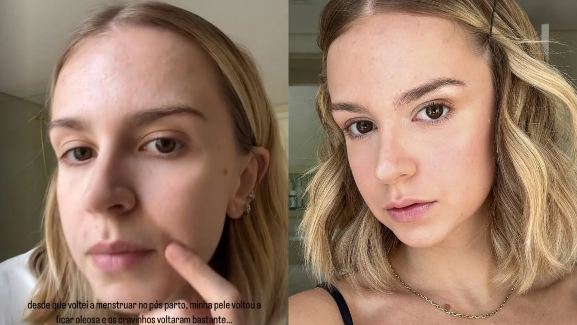Isabella Scherer mostra rosto sem maquiagem e aponta mudanças na pele após a gravidez