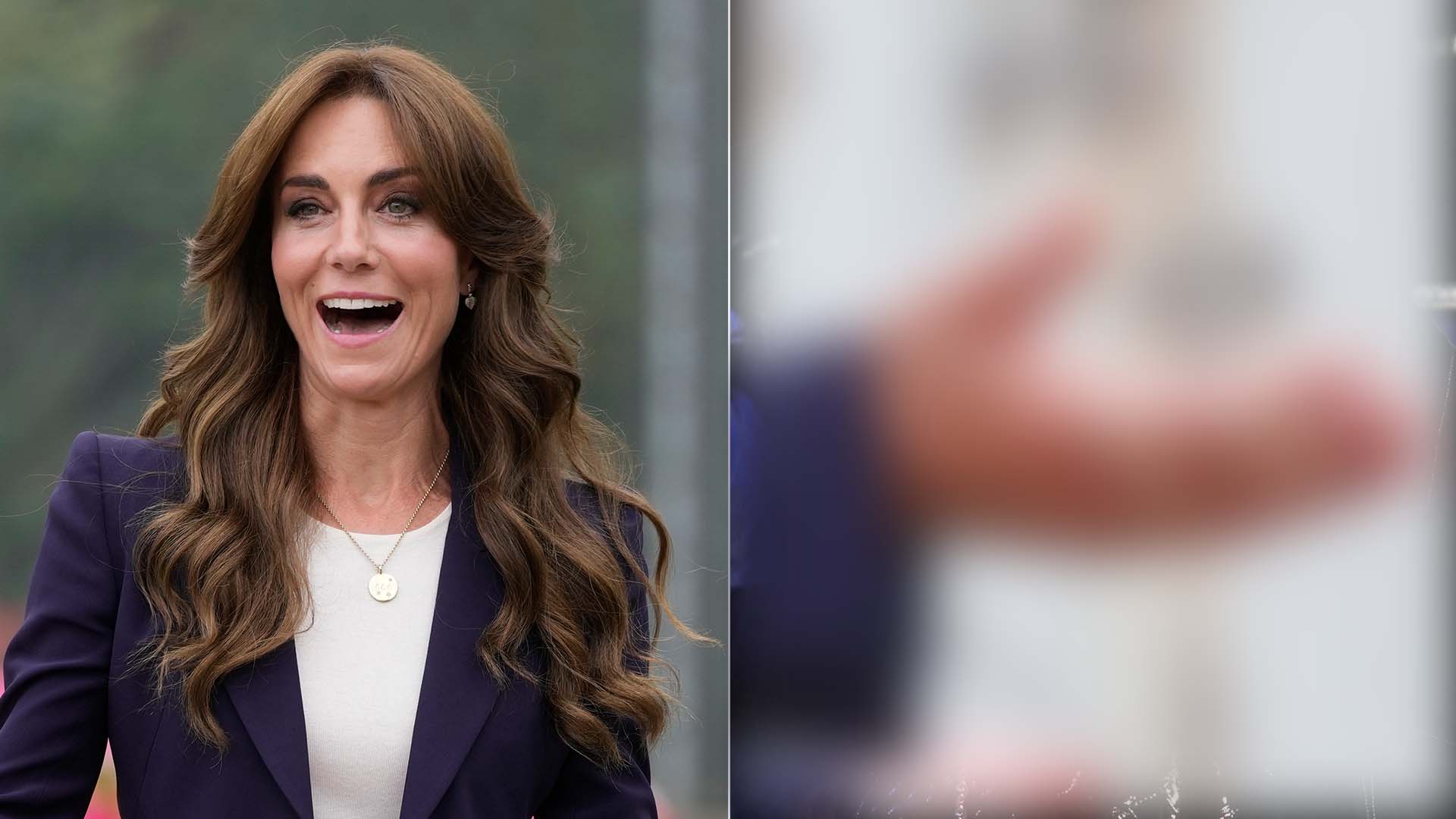 O que aconteceu com a mão de Kate Middleton? Palácio explica detalhe que roubou a cena