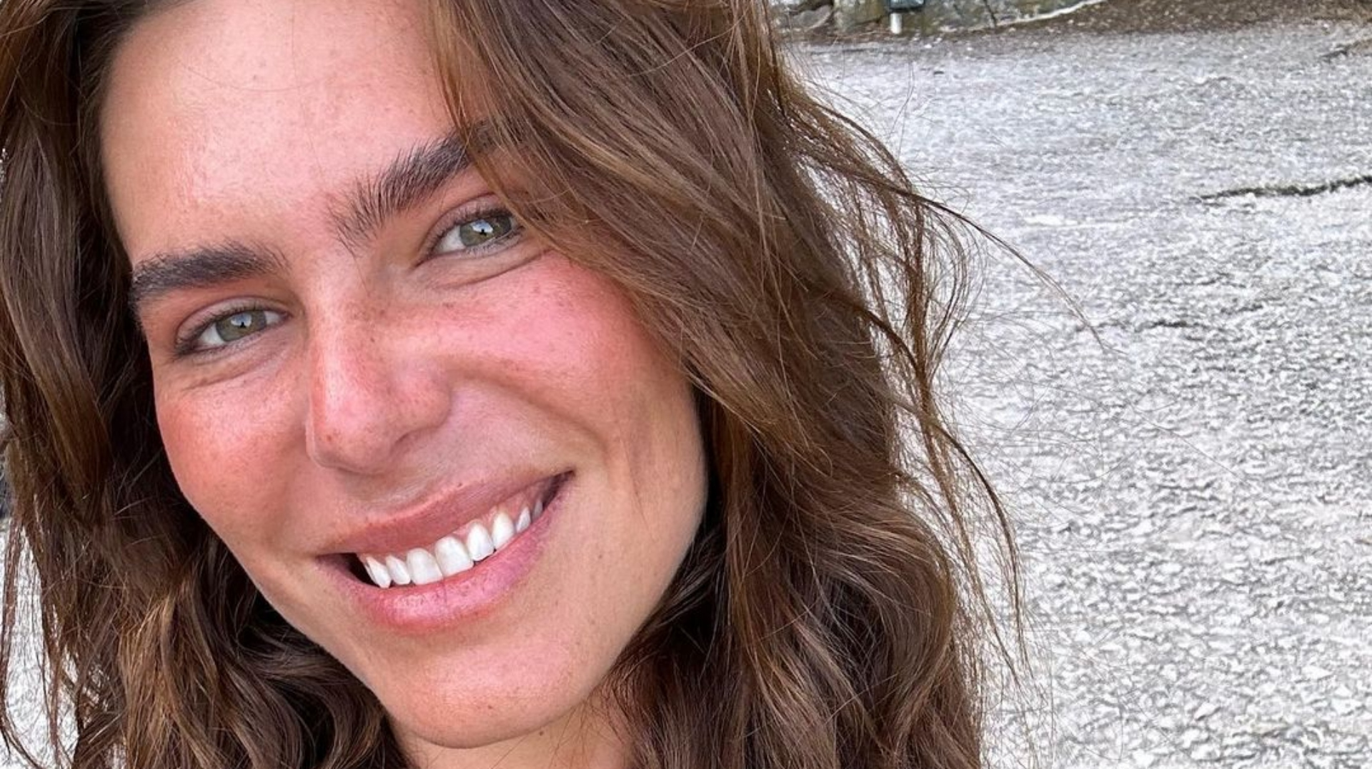 Mariana Goldfarb reflete sobre melasma e faz desabafo sobre manchas na pele: ‘Fica muito marcado’