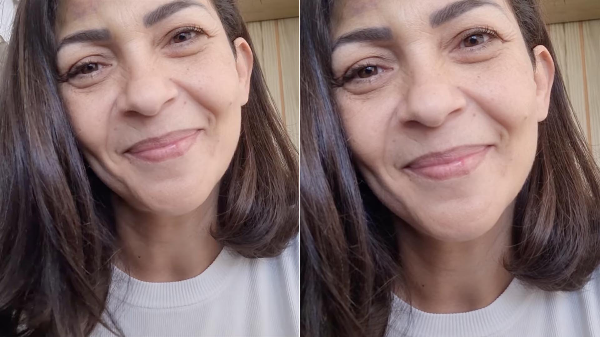 Marlei Cevada aparece com hematoma ao receber alta do hospital