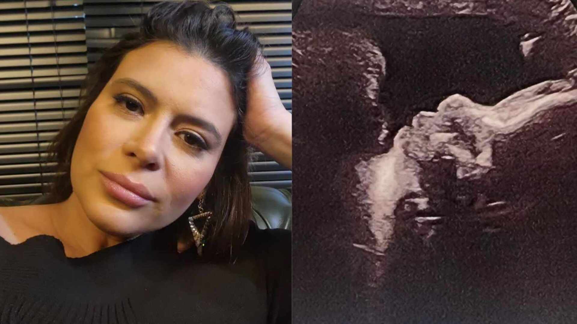 Grávida, Michelle Loreto sofre susto e vai para o hospital: ”Muito inchados”