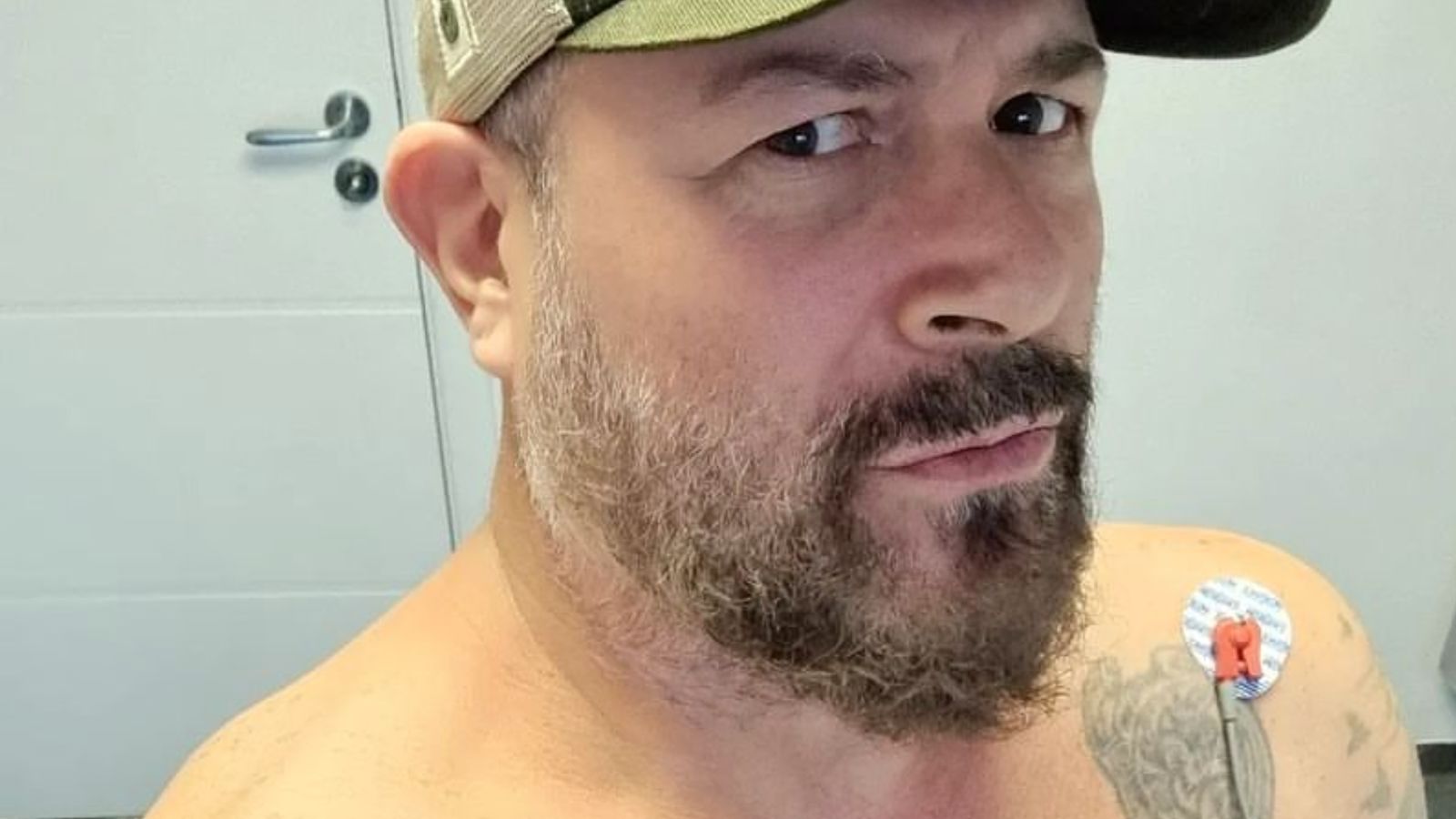 Mingau, do Ultraje a Rigor, passa por nova cirurgia para aliviar pressão na cabeça