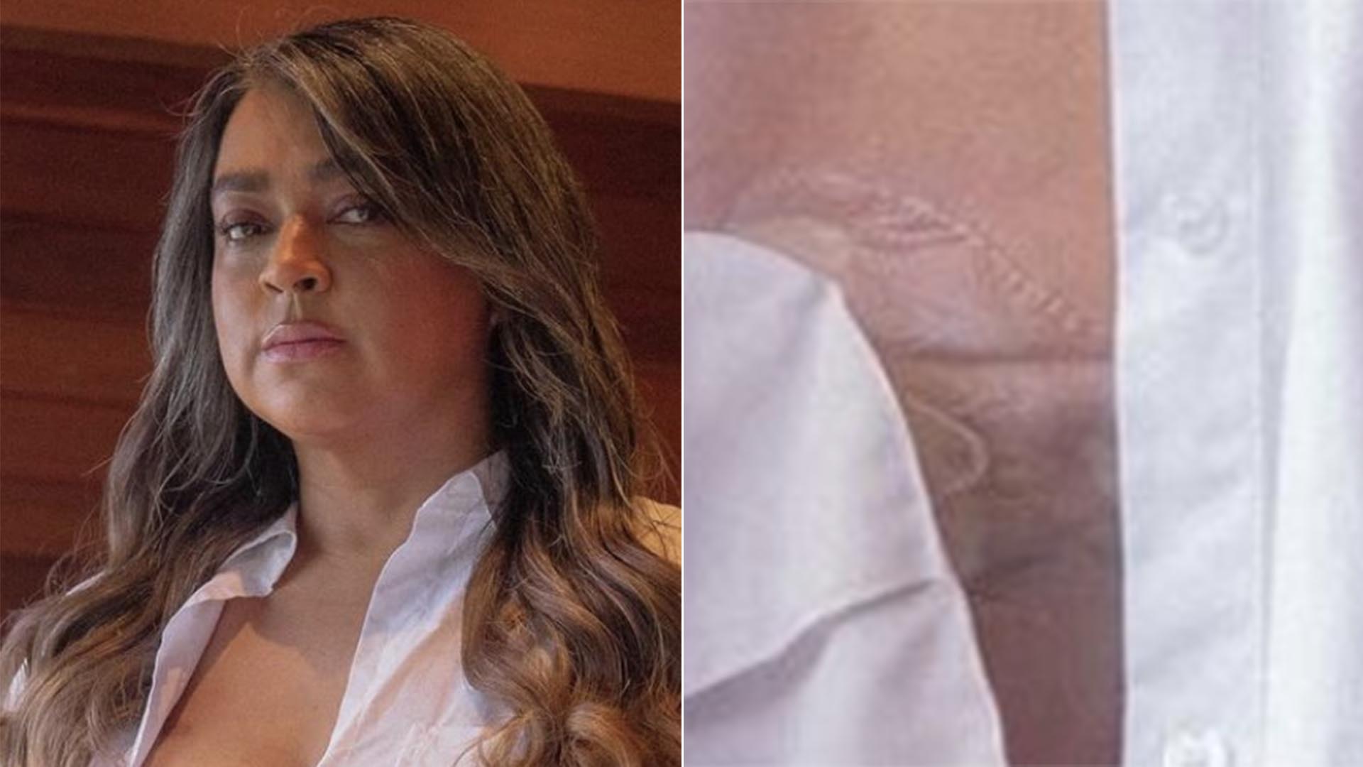 Preta Gil exibe a bolsa de ileostomia pela primeira vez: ‘Não tenho vergonha’