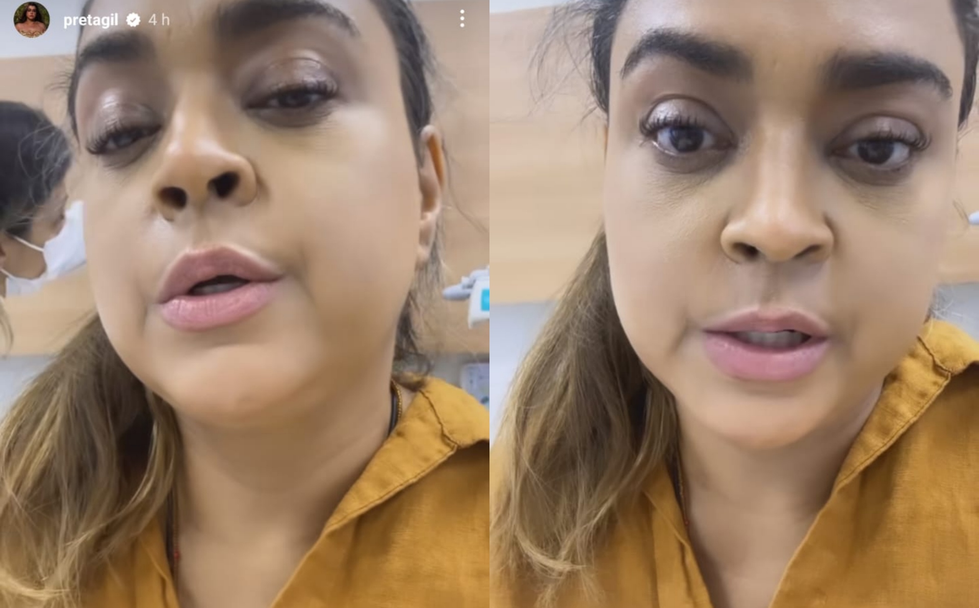 Preta Gil mata curiosidade dos fãs e revela como é sua rotina pós-operatória; confira