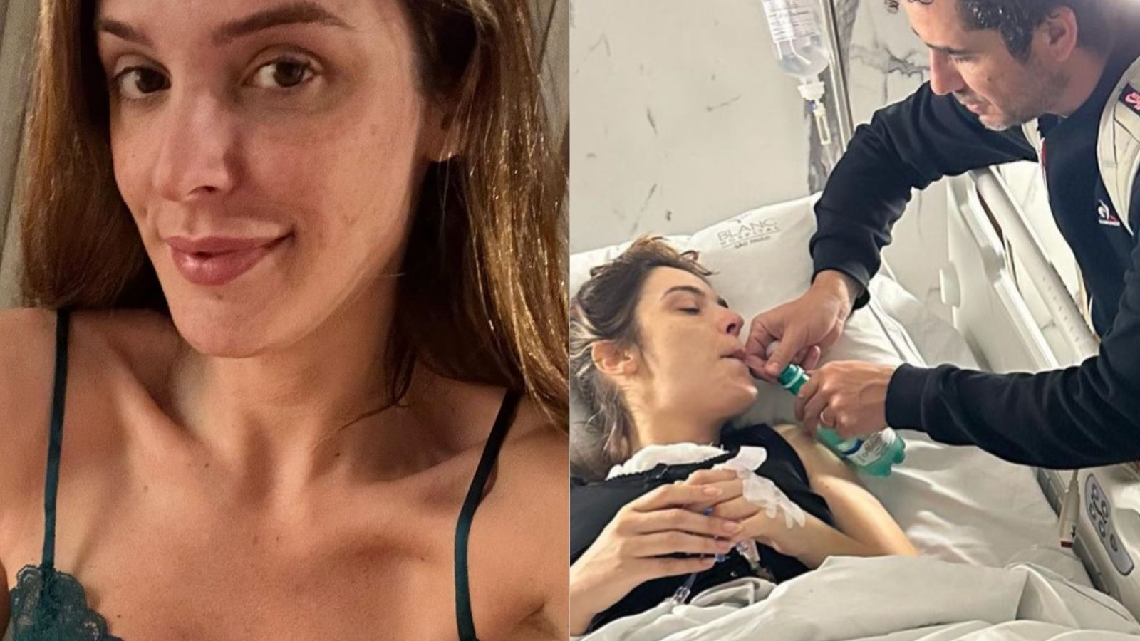 Rafa Brites exibe resultado de explante de silicone: ‘Processo bem delicado’