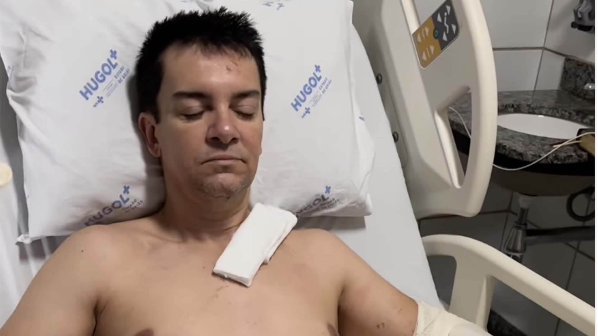 Internado, Regis Danese impressiona ao mostrar cicatriz após cirurgia
