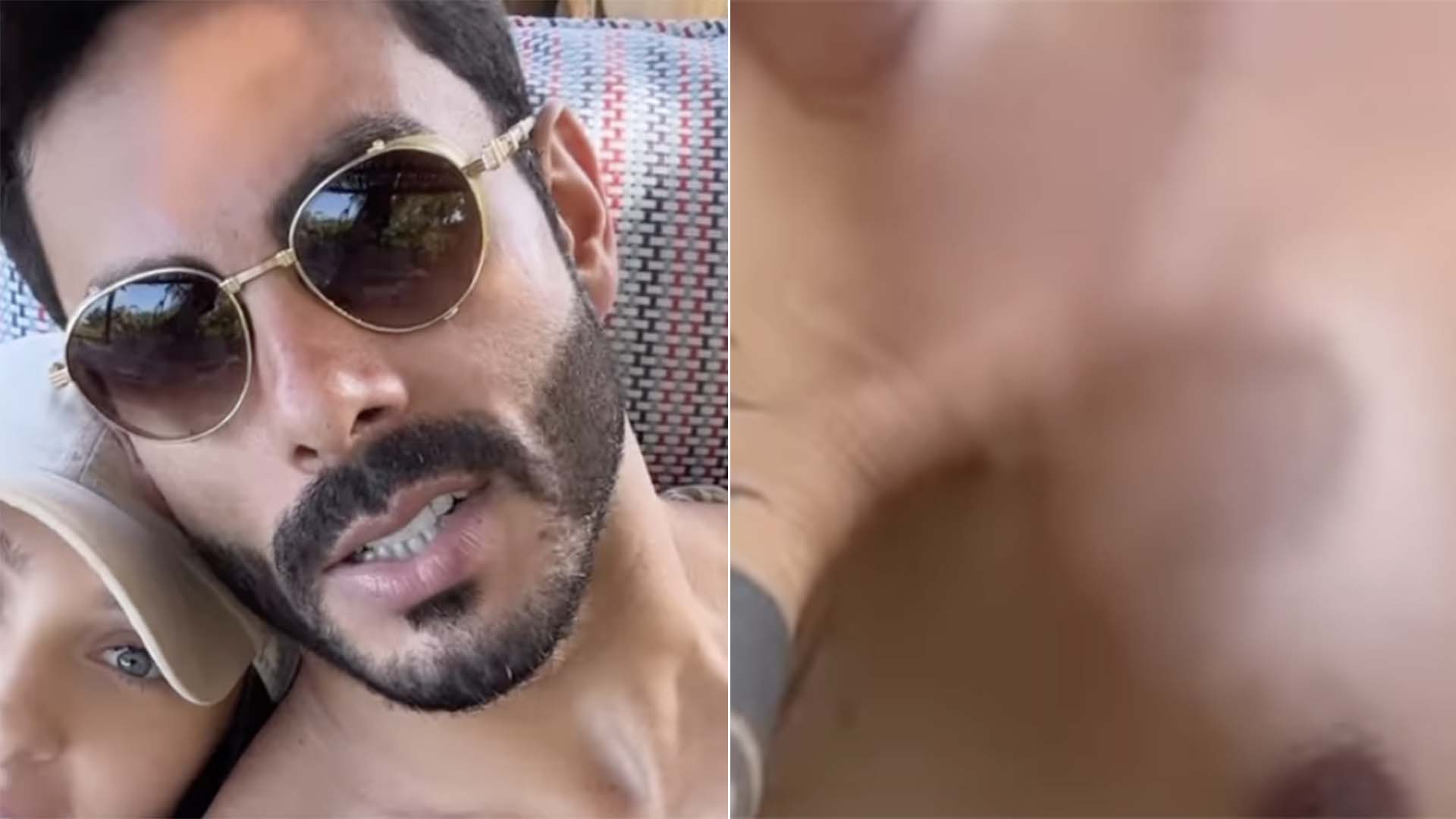 Que buraco é esse? Rodolffo explica diferença em seu corpo