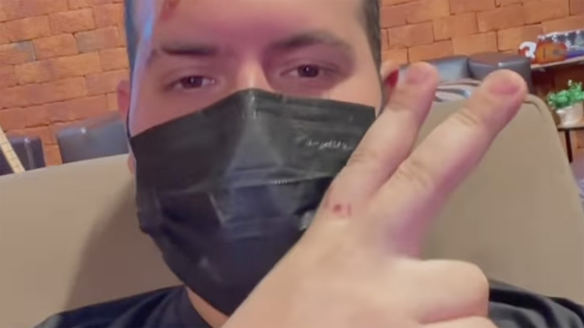 Sertanejo Zé Ottavio aparece com machucado após acidente de jet ski