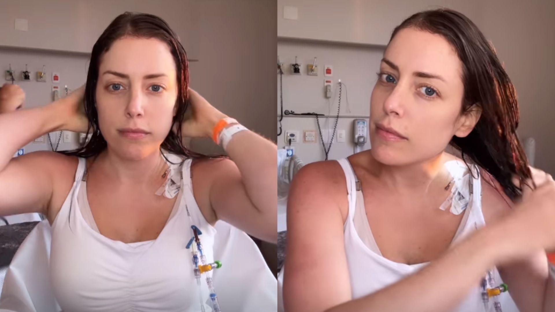 Após iniciar quimioterapia, Fabiana Justus mostra como cuida do cabelo