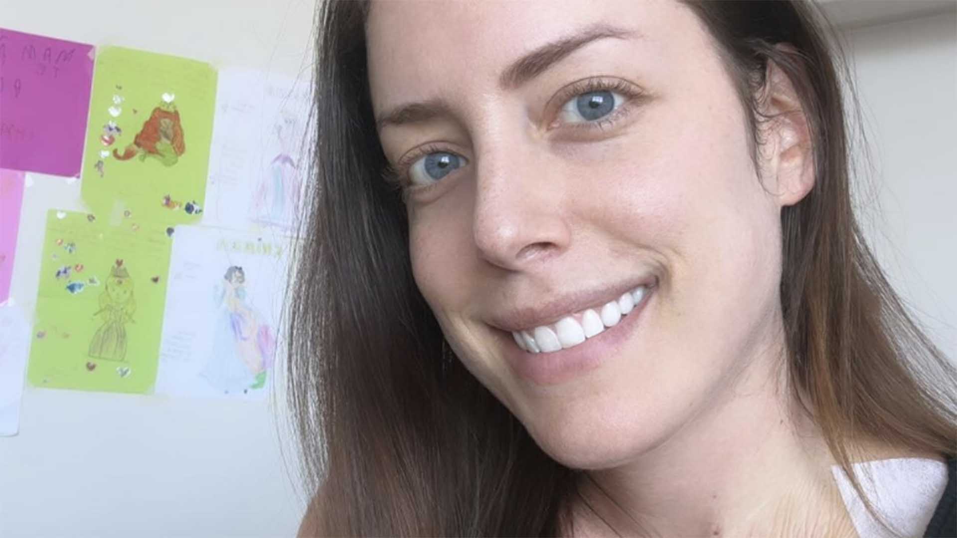 Fabiana Justus começa a perder cabelo em luta contra o câncer: ‘Sem parar’