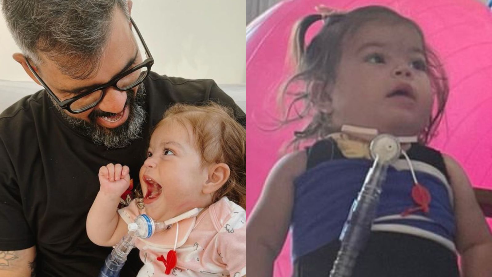 Filha de Juliano Cazarré fica em pé pela primeira vez: “Pequeno milagre”