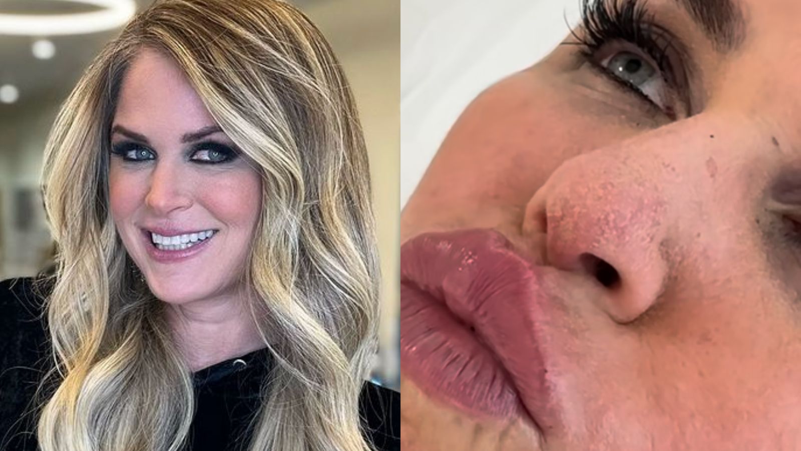 O que Susana Werner fez no rosto? Empresária impressiona com transformação