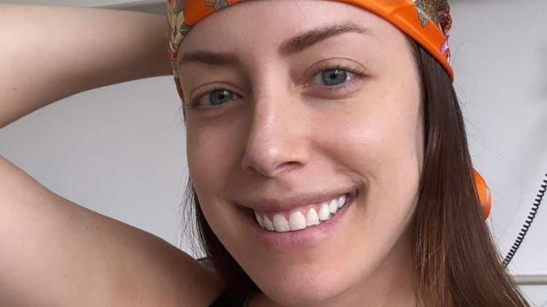 Em tratamento contra leucemia, Fabiana Justus mostra queda de cabelo