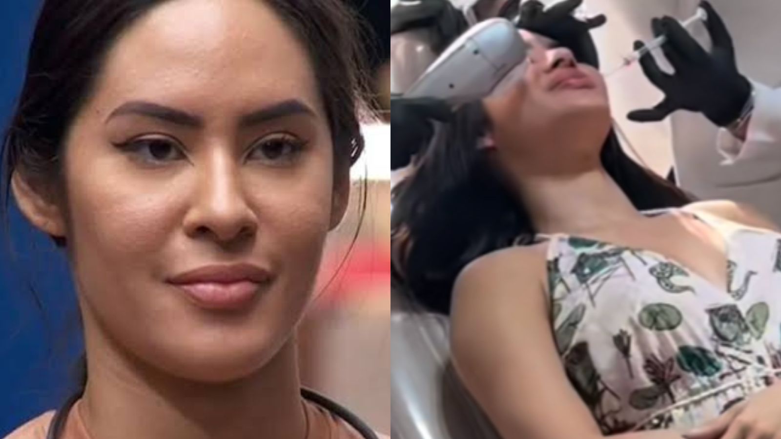 BBB 24: O que Isabelle fez no rosto? Cunhã passou por mudanças antes do reality