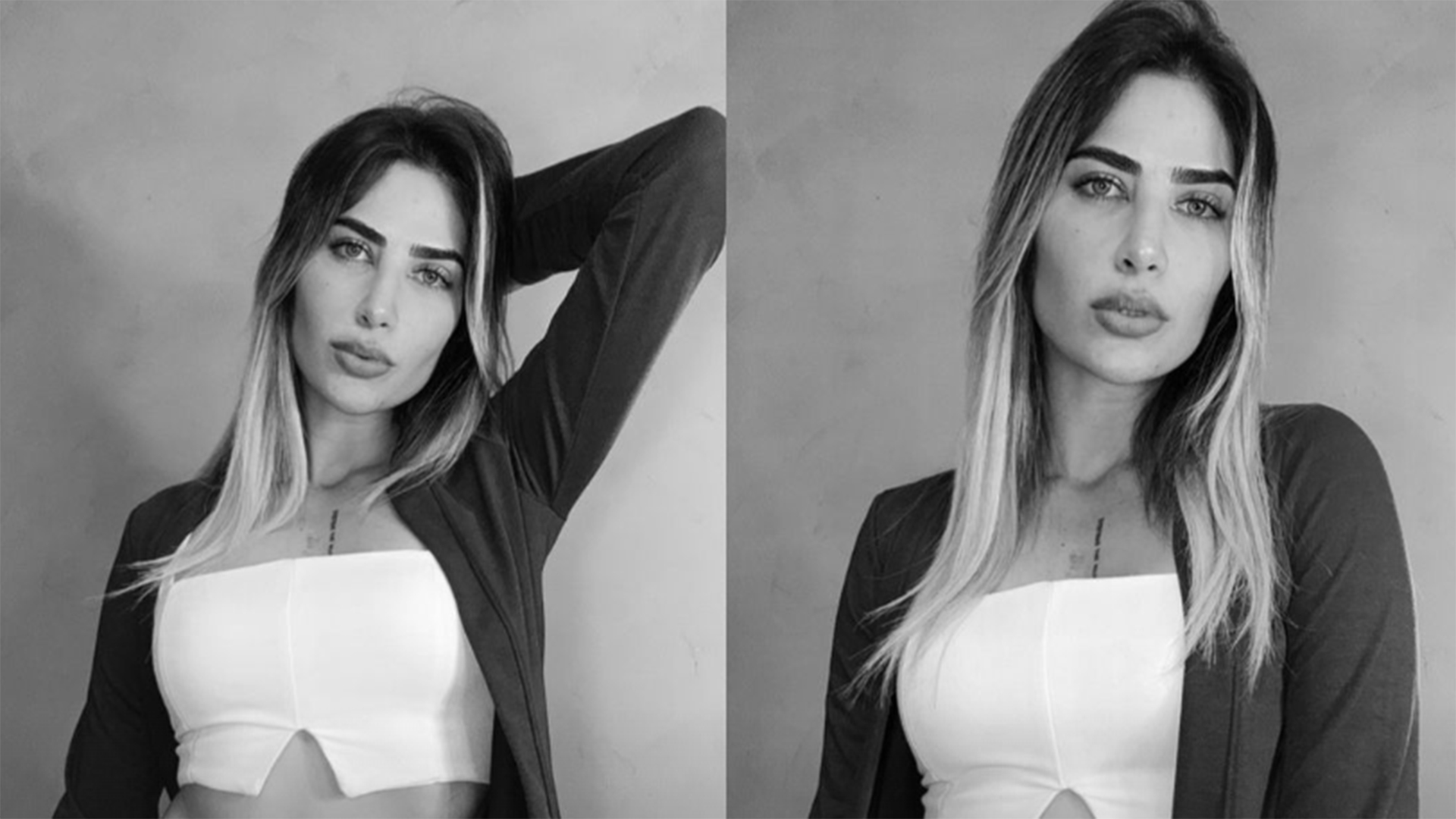 Filha de Leonardo, Jéssica Beatriz revela o resultado da abdominoplastia