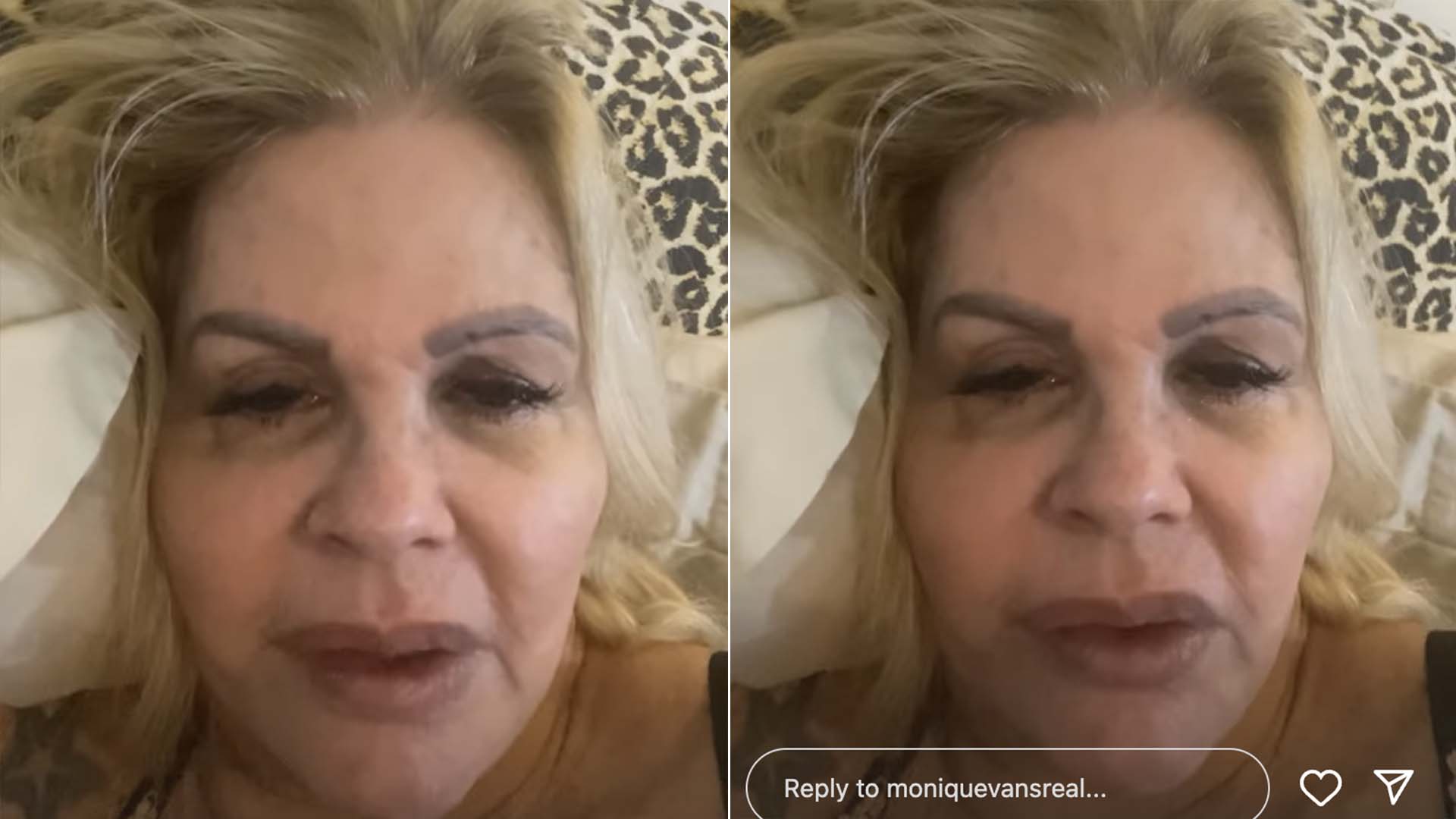 Com dengue, Monique Evans desabafa: ‘Que bichinho miserável’
