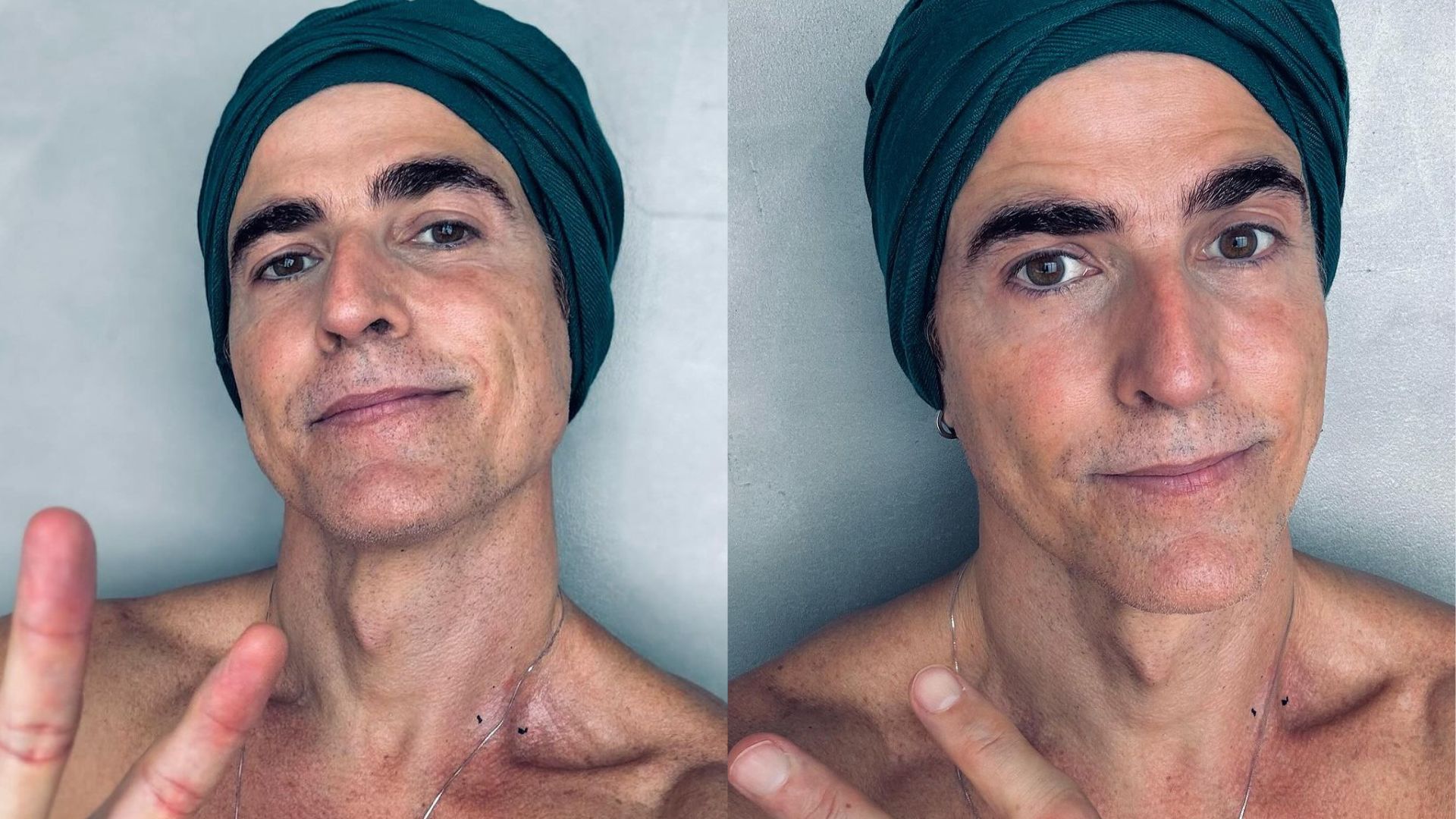 Reynaldo Gianecchini relembra diagnóstico de câncer: ‘É possível vencer’