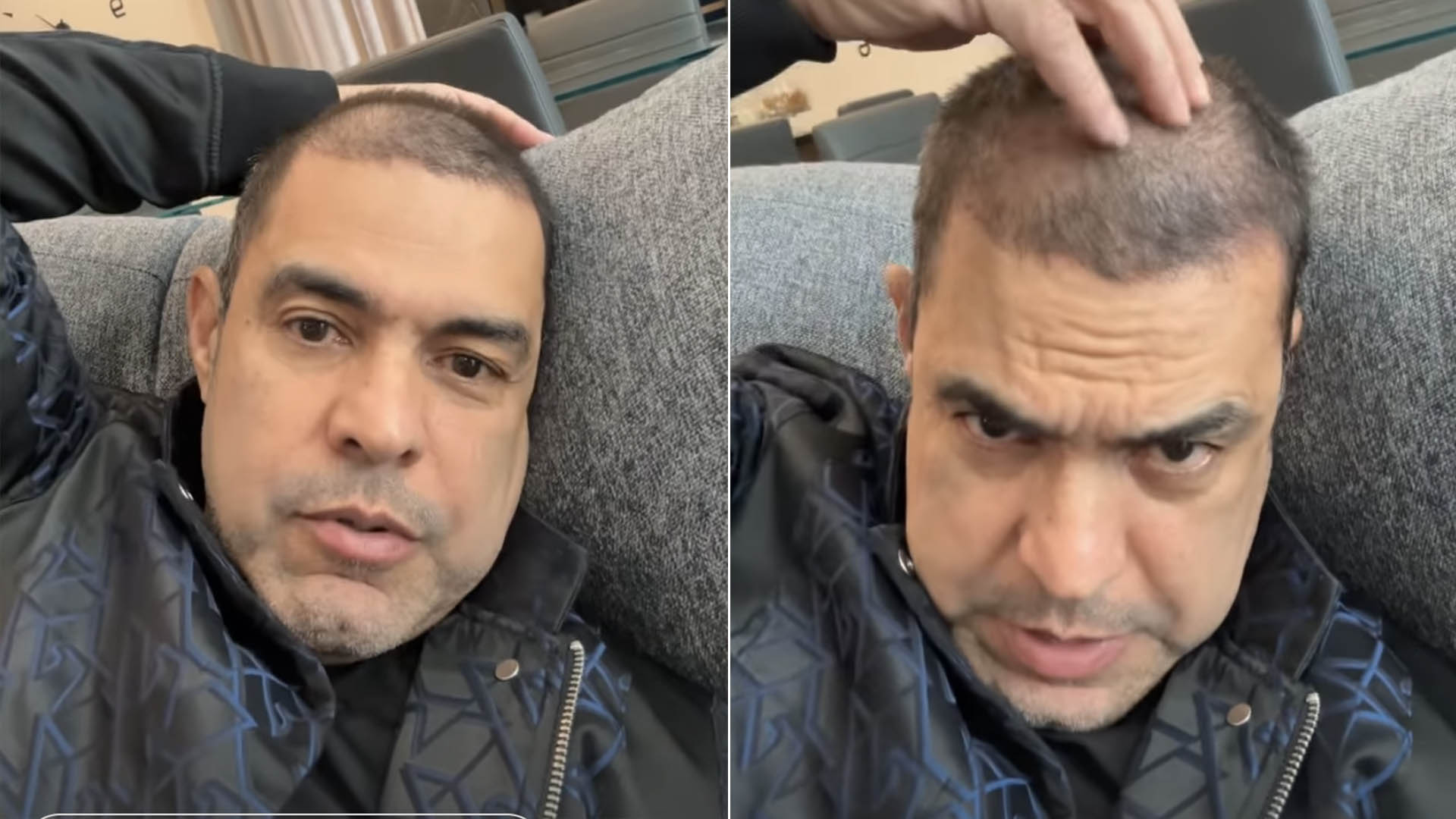Zezé Di Camargo explica o que aconteceu com seu cabelo: ‘Tá careca?’