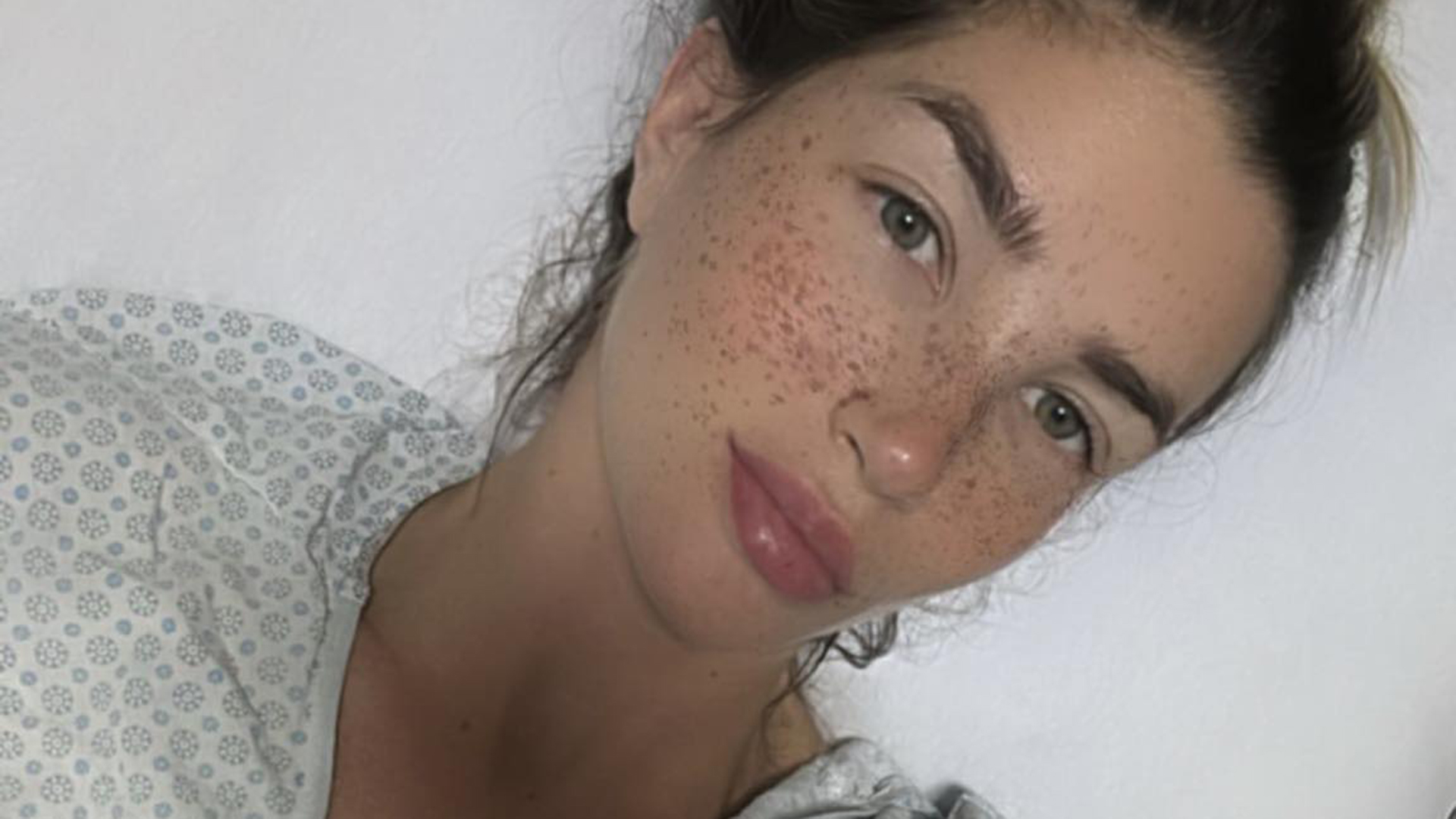 Ex-BBB Aline Gotschalg é internada na UTI e revela o que aconteceu