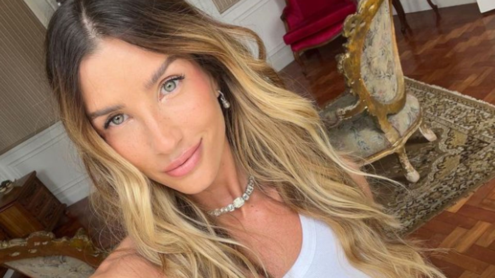 Ex-BBB Aline Gotschalg tem alta médica após internação na UTI