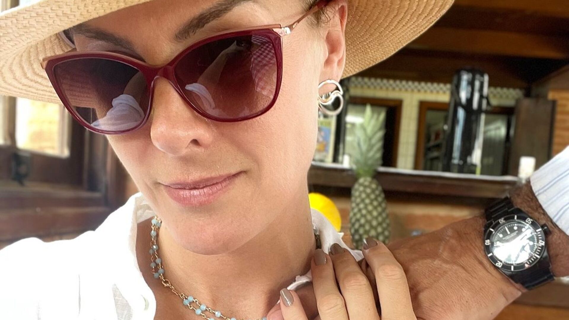 Ana Hickmann fica surpresa com reações após assumir Edu Guedes