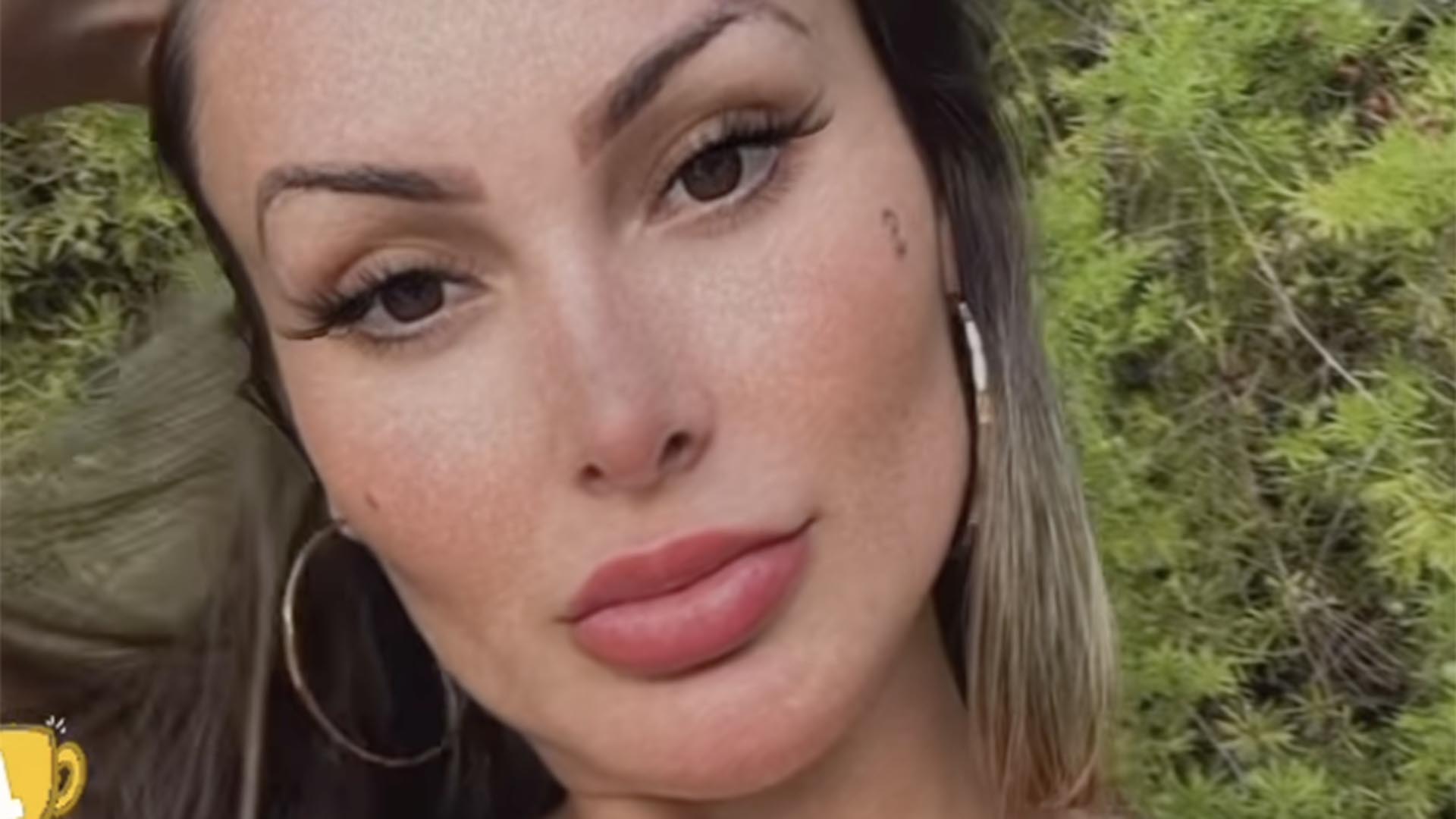 Andressa Urach mostra sua cintura após remover as costelas
