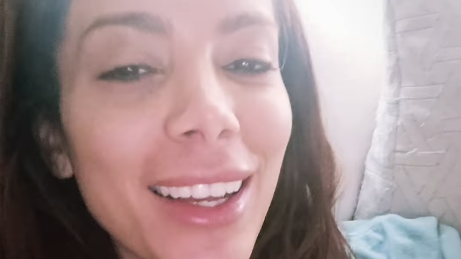 Anitta surge com hematoma após festa e revela o que aconteceu