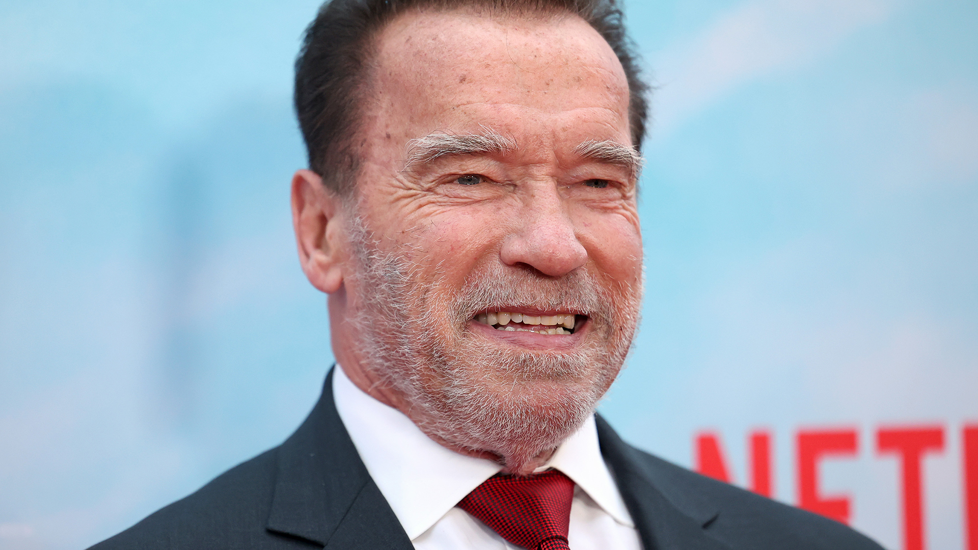 Arnold Schwarzenegger passa por cirurgia para colocar marca-passo