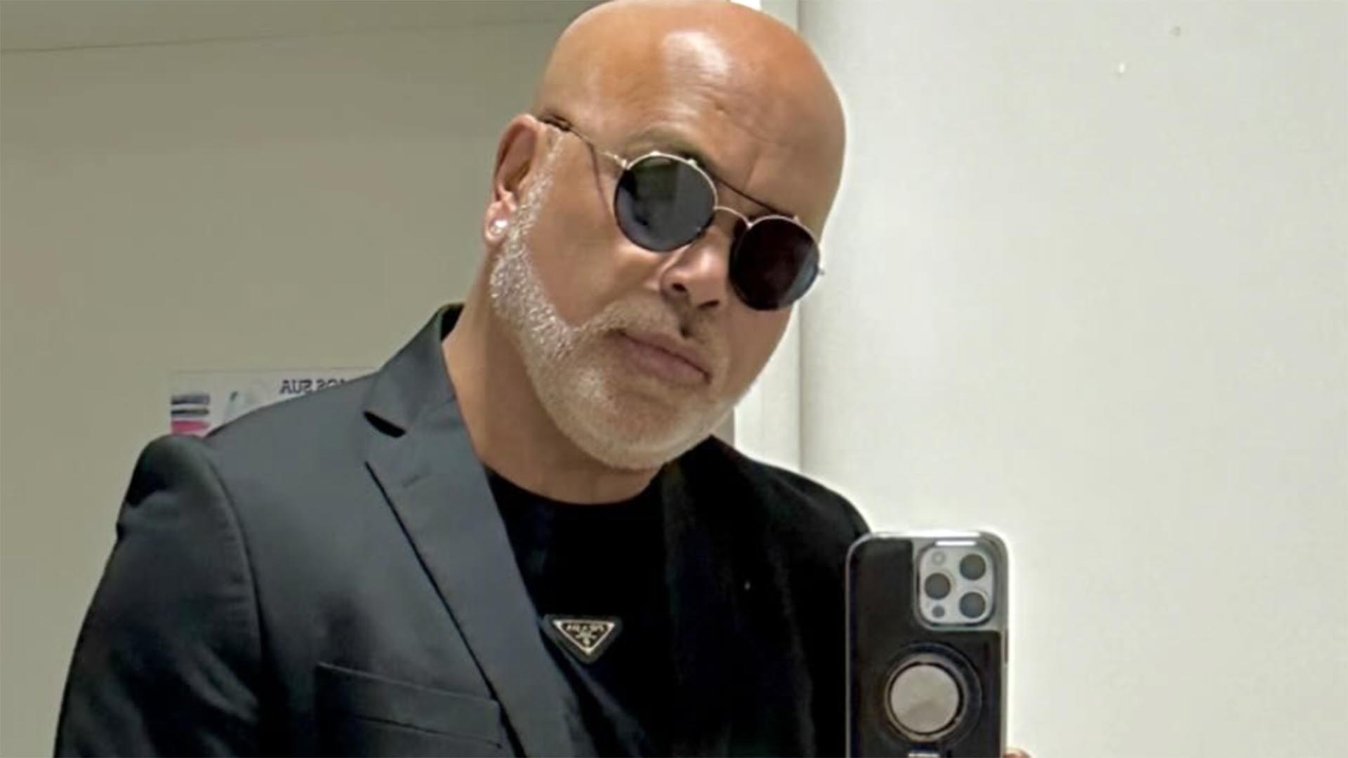 Cantor Rick impressiona com resultado da harmonização facial