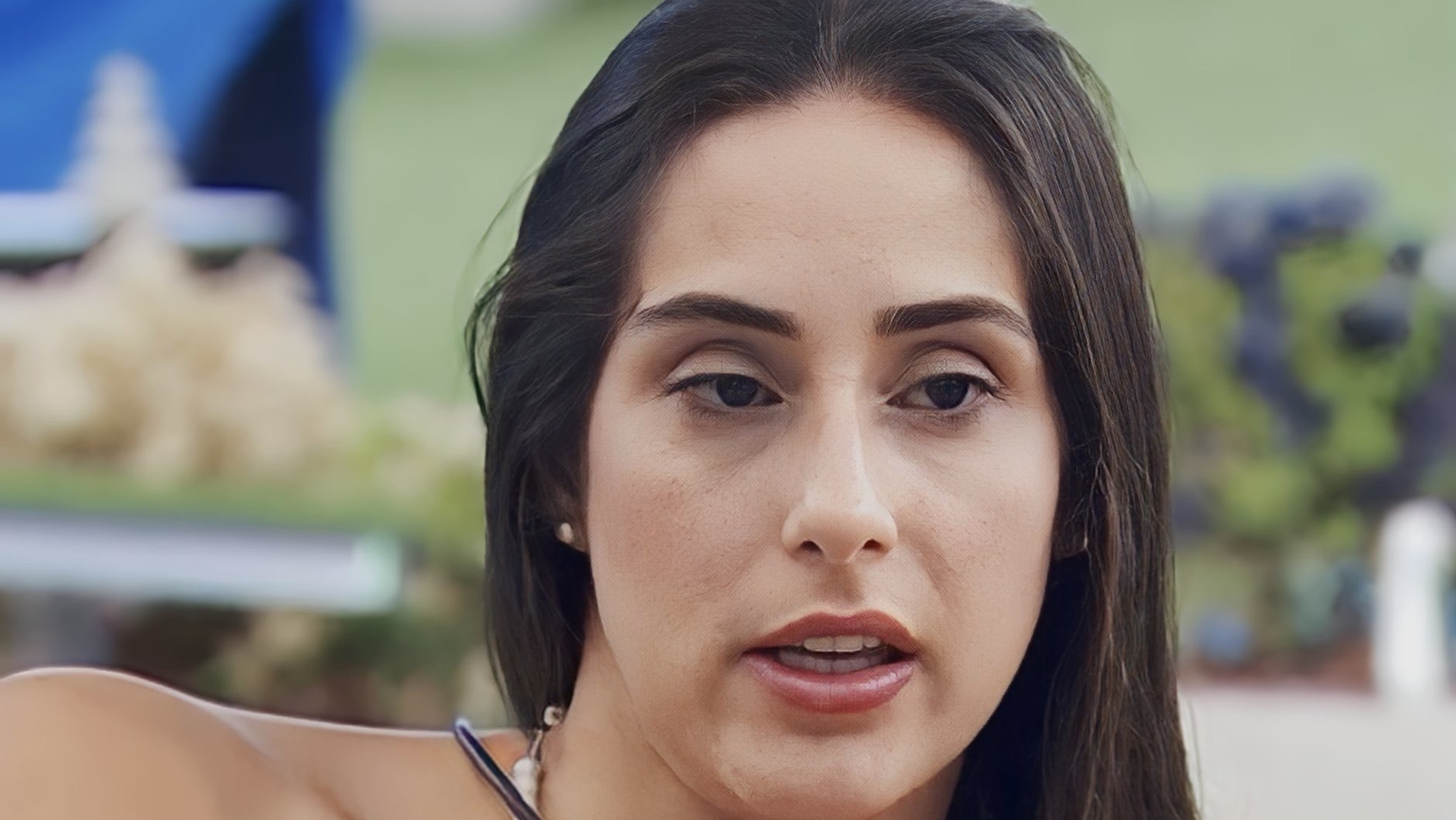 O que é olho preguiçoso? Condição revelada pela ex-BBB Deniziane é irreversível