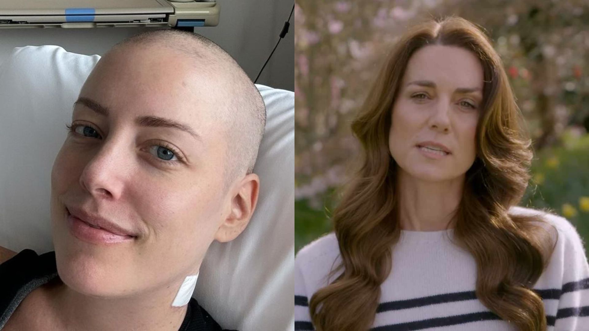 Com câncer, Fabiana Justus se identifica com história de Kate Middleton