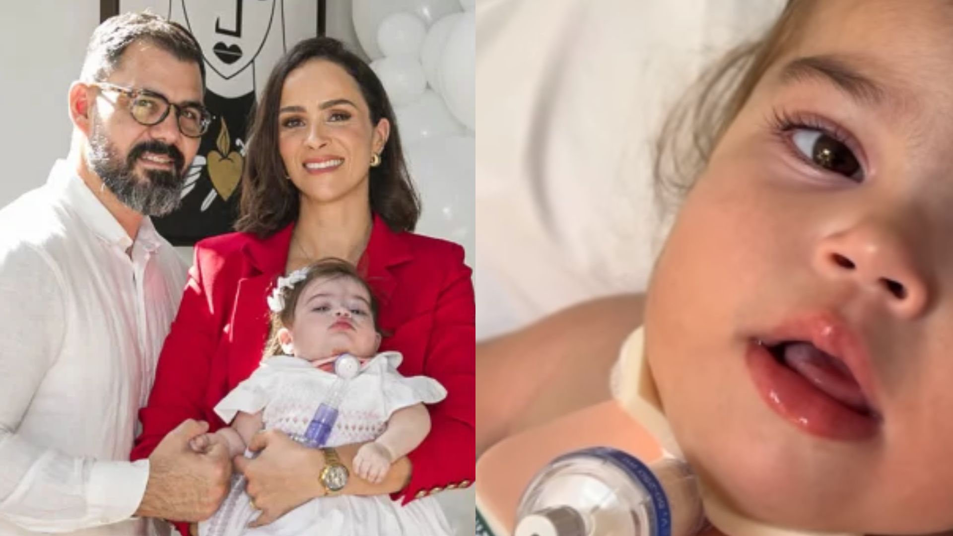 Juliano Cazarré fala sobre recuperação da filha após nova cirurgia: ‘Corajosa’