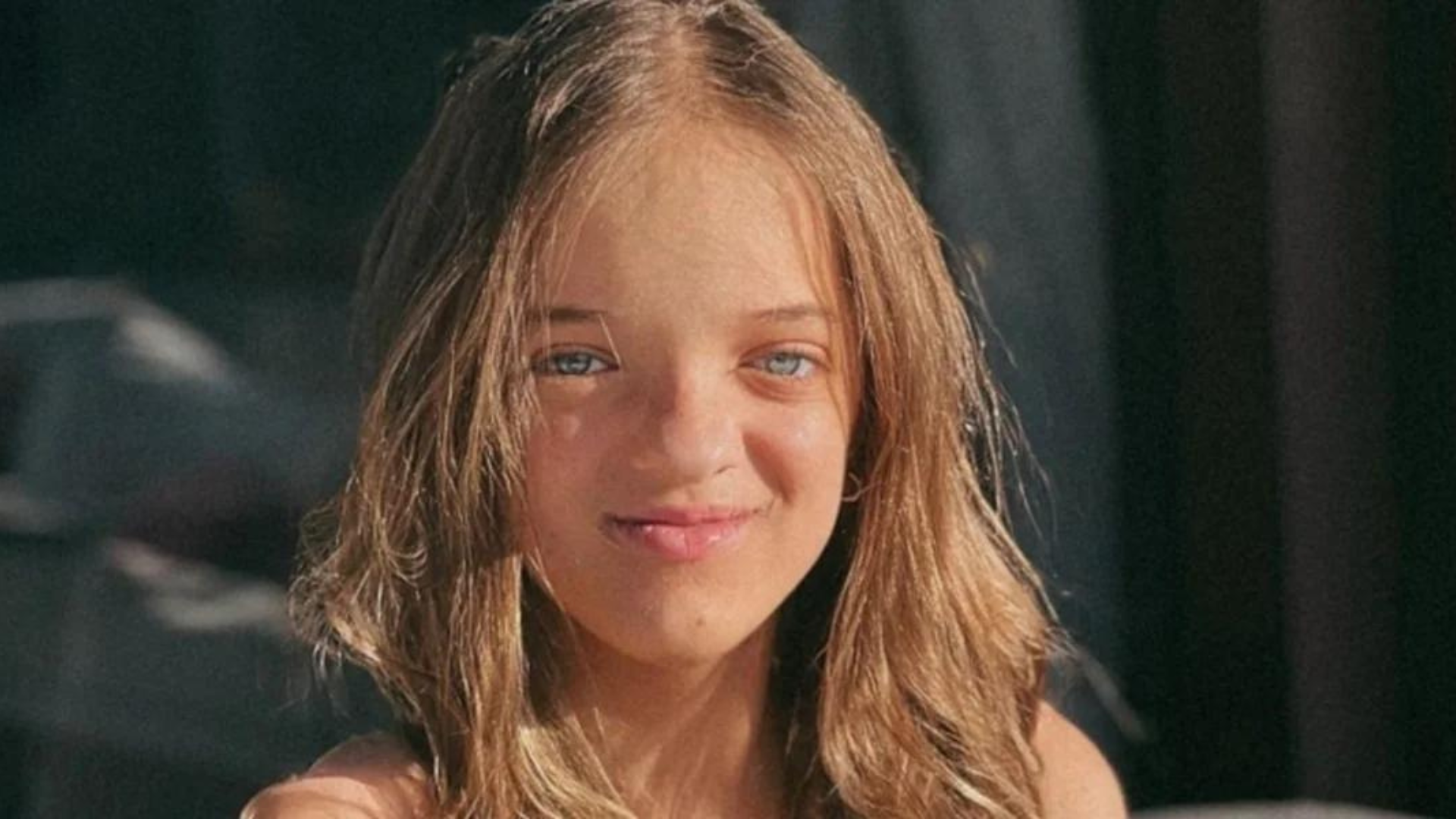 Mudou? Confira antes e depois de rinoplastia de Rafaella Justus